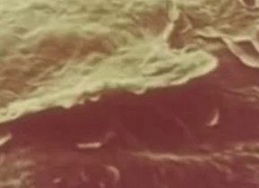 ороговевшая клетка кожи под микроскопом